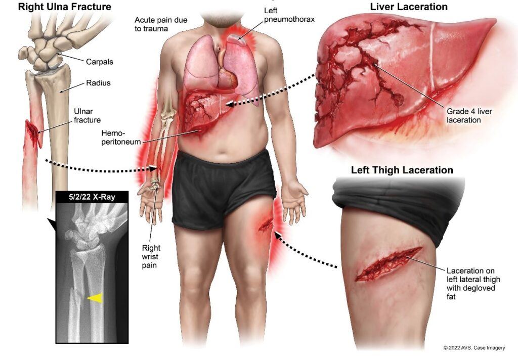 Mr. Ramos’ injuries
